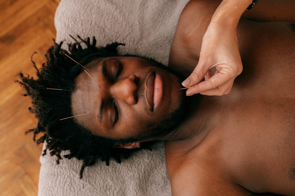 Acupuncture for chronic fatigue